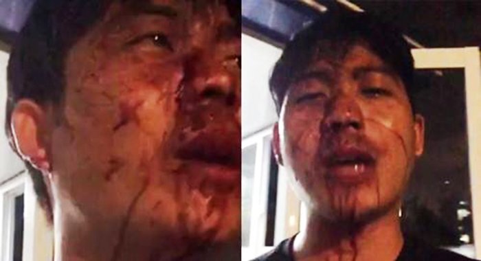 Bảo vệ chung cư Opal Riverside của Tập đoàn Đất Xanh đánh cư dân nhập viện