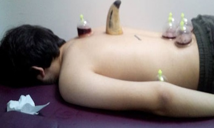 Đóng cửa trạm y tế chữa bệnh theo kiểu trừ tà ma