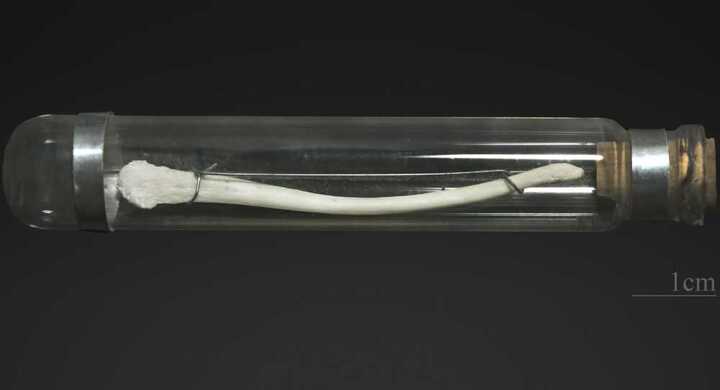 Bí hiểm ‘của quý’ của nam giới không có xương