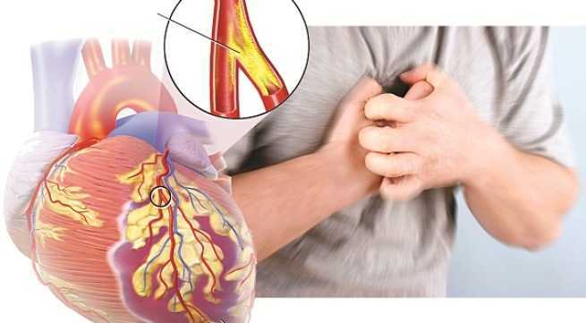 Bệnh nào giết chết nhiều người nhất trên thế giới?