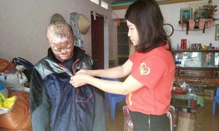 Xót xa cậu bé mắc bệnh 'mặt quỷ’ và ước mơ một lần được đến trường