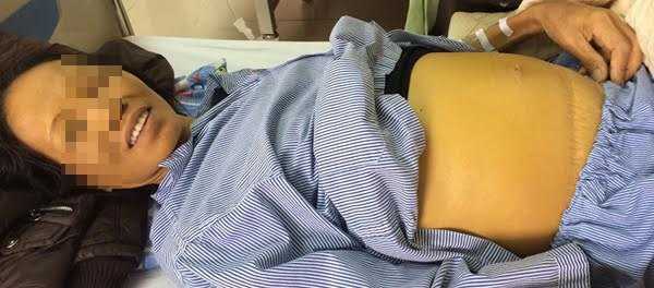 Bệnh viện K: Bệnh nhân đang mổ vẫn tỉnh táo nói chuyện với bác sĩ