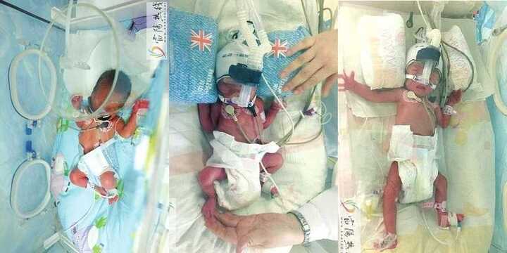 Kỳ diệu: Người phụ nữ sinh 3 con cách nhau 1 tuần