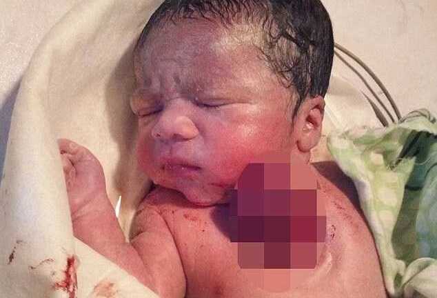 Cha mẹ chết ngất khi thấy tim con nằm ngoài cơ thể