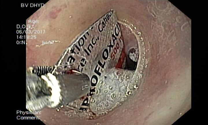 Uống thuốc nuốt luôn cả vỏ, một phụ nữ suýt mất mạng