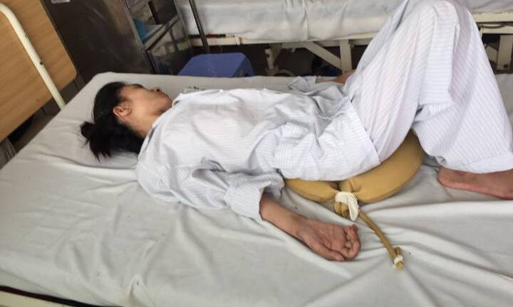 Chữa đau khớp gối bằng thuốc nam, một bệnh nhân bị liệt 2 chân