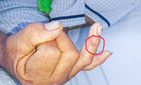 Làm gì để bảo toàn tính mạng khi bị rắn lục đuôi đỏ tấn công?