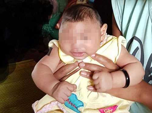Đắk Lắk: Xuất hiện bệnh nhi mắc chứng đầu nhỏ nghi do virus Zika