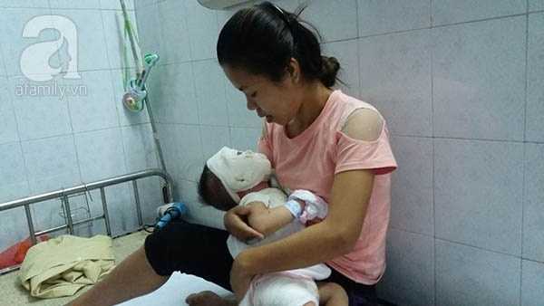 Một phút sơ sẩy của mẹ, con trai 11 tháng tuổi bị ấm nước sôi dội xuống đầu