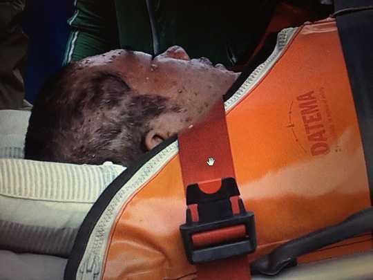 Ngư dân nguy kịch giữa biển khơi do ăn cá lạ