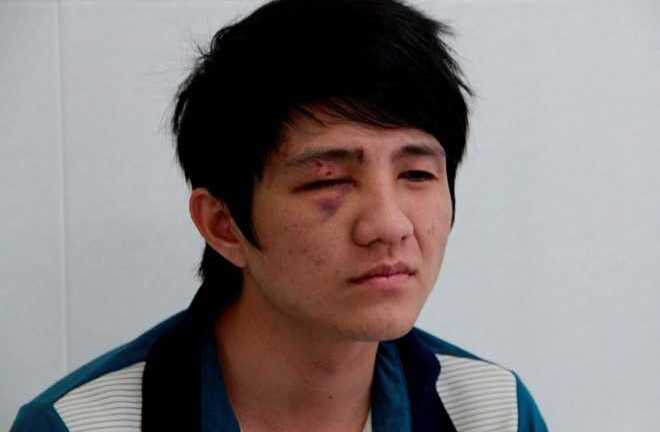 Người đi đường bầm mắt do 'đập mặt vào gậy' CSGT