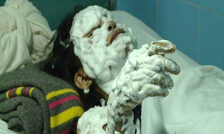 Chùm bóng bay nổ đêm trung thu, 9 người bị thương