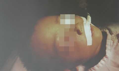 Chú lấy súng tự chế ra dọa, bắn luôn vào mắt cháu