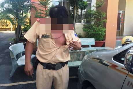 Bị dừng xe, kẻ nhiễm HIV tấn công, cắn CSGT chảy máu