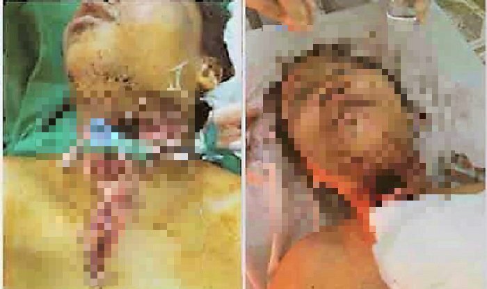 Sau khi cưỡng hiếp, hành hung dã man bé gái 14 tuổi, nghi phạm bình thản trở về nhà
