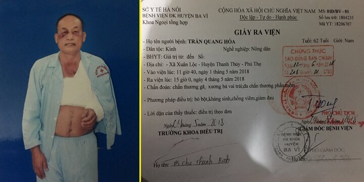 Bị đánh gãy xương vai còn bị phạt hành chính: Giám đốc Công an Phú Thọ chỉ đạo