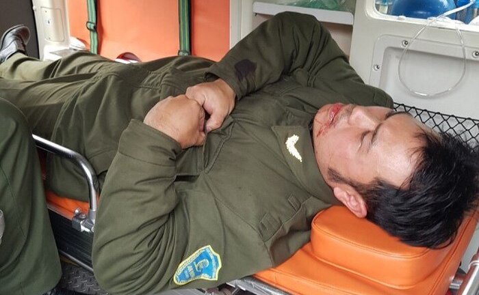 Nhân viên an ninh sân bay bị cò mồi taxi đánh gãy 4 răng cửa: Công an vào cuộc