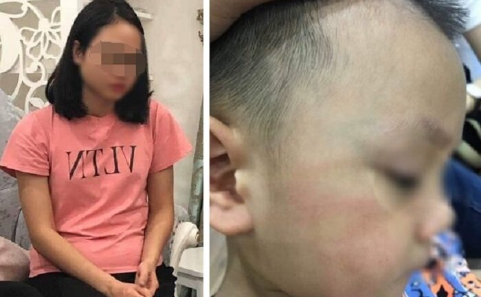 Đánh trẻ 3 tuổi ở Hà Nội bầm dập, tụ máu môi, cô giáo hoảng loạn, tìm cách tự tử