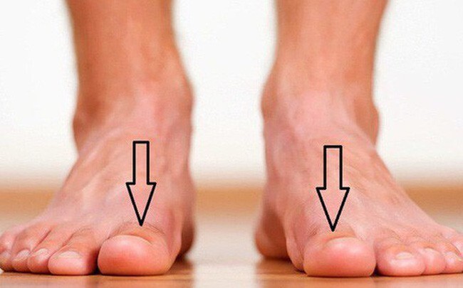 Dấu hiệu từ bàn chân cảnh báo bạn dễ đang mang 'trọng bệnh'
