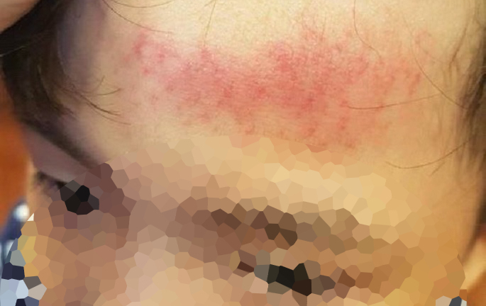 Học sinh ngã sưng đầu, hiệu trưởng bị tố 'phủi' trách nhiệm: Đại diện nhà trường nói gì?