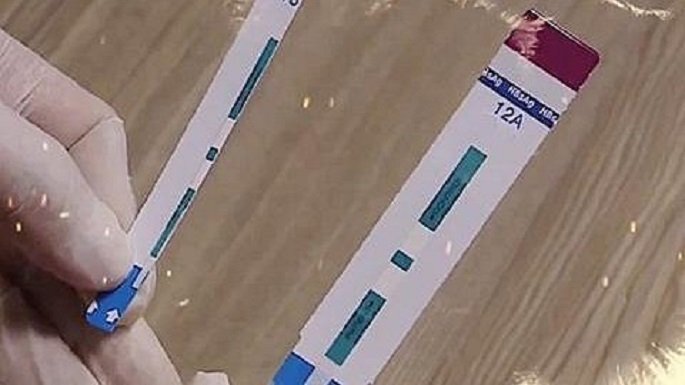 'Chẻ đôi' que thử HIV tại Bệnh viện Xanh Pôn: Phó khoa tự ý chỉ đạo nhân viên