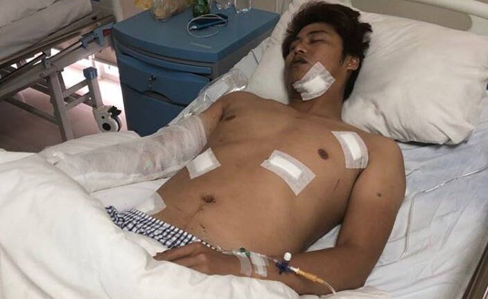 Bênh vực nữ nhân viên, giám đốc bị kẻ côn đồ xăm trổ chém trọng thương