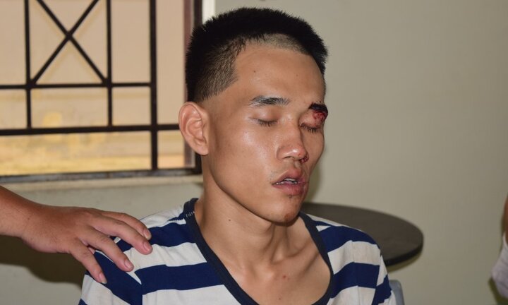 Khởi tố sát thủ cứa cổ khách đến dự đám tang bố ruột