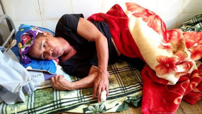 Đi làm rẫy, người đàn ông bị lợn rừng nặng gần 1 tạ tấn công