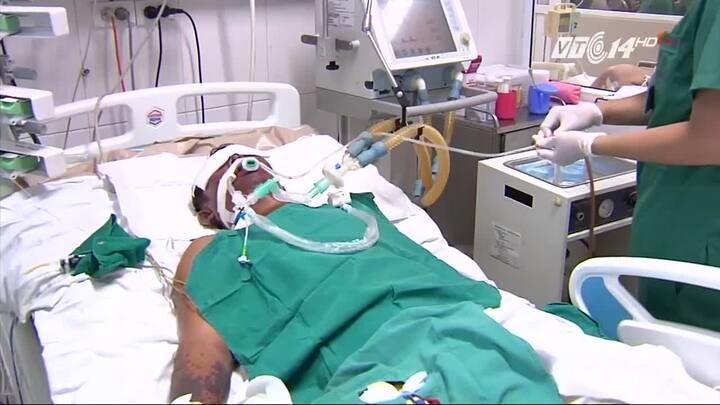 Giết mổ lợn ốm, người đàn ông bị hoại tử chân tay, nguy kịch tính mạng