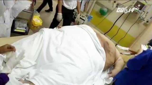 Ăn 30 tô mỳ, chàng béo nặng 317kg nhập viện bằng xe tải