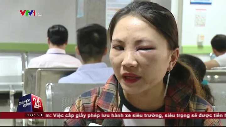 Nhầm lẫn tai hại khiến vết đốt của kiến ba khoang trở nên cực nguy hiểm