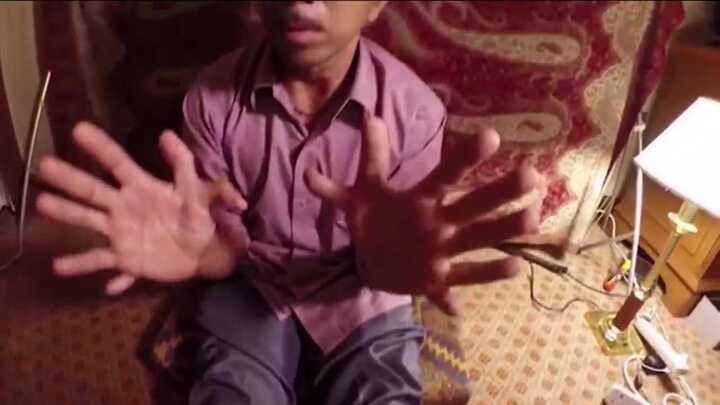 Kỳ lạ gia đình ai cũng có 12 ngón tay, 12 ngón chân trở lên ở Ấn Độ