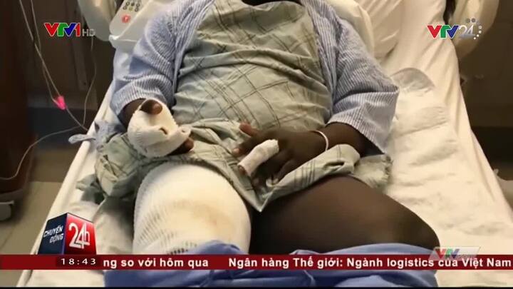 Thuốc lá điện tử phát nổ trong túi quần, người đàn ông bỏng nặng