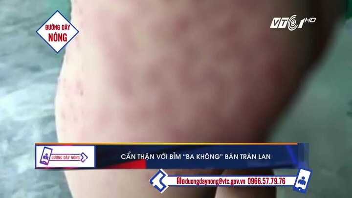 Hậu quả đáng sợ khi dùng bỉm siêu rẻ tràn lan thị trường