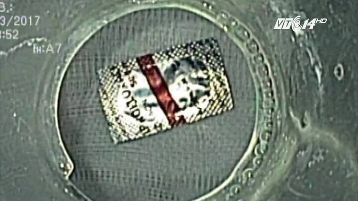 Tây Ninh: Suýt thủng ruột vì uống thuốc nuốt luôn cả vỏ