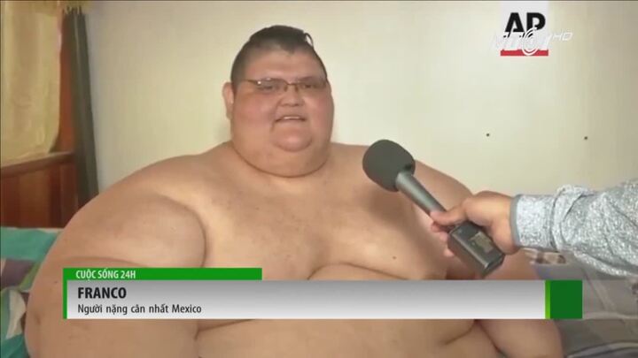 Người béo nhất Mexico chuẩn bị lên bàn mổ phẫu thuật giảm cân