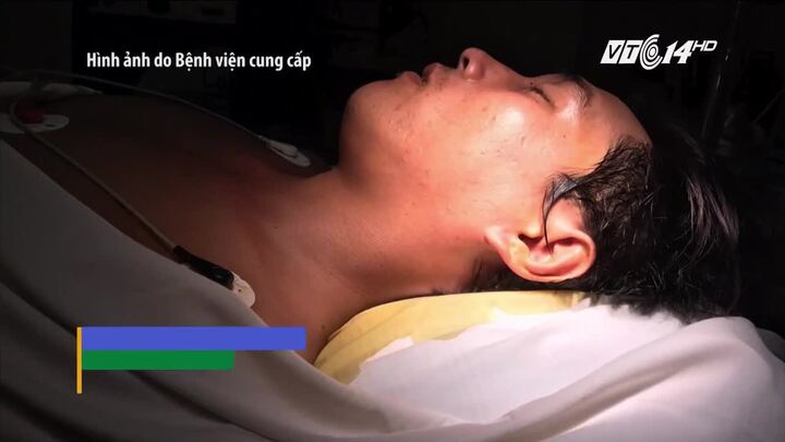 Cãi nhau, em dùng đũa dài 13 cm đâm anh xuyên từ tai xuống họng