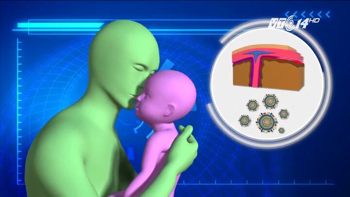 Bé gái 18 ngày tuổi chết thương tâm vì nụ hôn 'tử thần' của người lạ