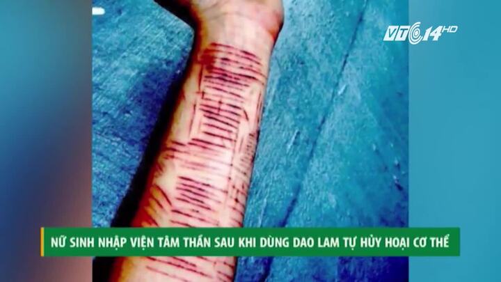 Dùng dao lam tự hủy hoại cơ thể, nữ sinh nhập viện tâm thần