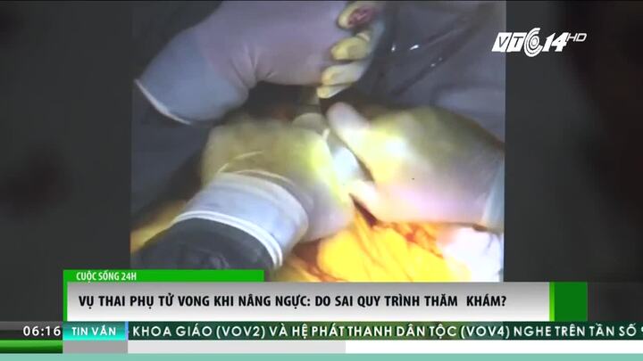 Lộ nguyên nhân thai phụ thiệt mạng khi nâng ngực