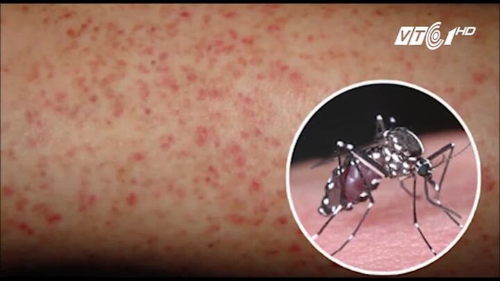 Nếu bạn lo cho sức khỏe trước dịch sốt xuất huyết, không được bỏ qua clip này