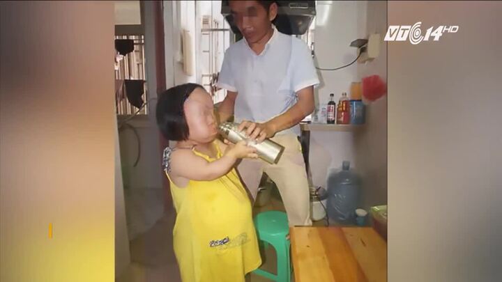 Phụ nữ cao 90 cm mang bầu bất chấp rủi ro