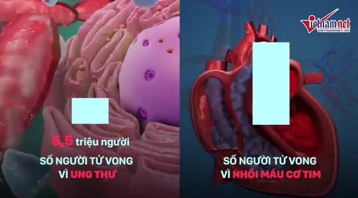 Đây là căn bệnh 'chết ngay tức khắc' đáng sợ hơn cả ung thư