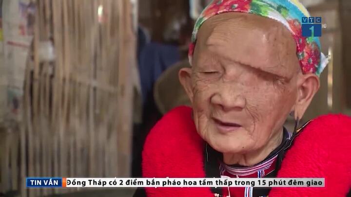 Cuộc sống mới của 'sơn nữ mặt quỷ' sau khi cắt bỏ khối u 4 kg trên mặt