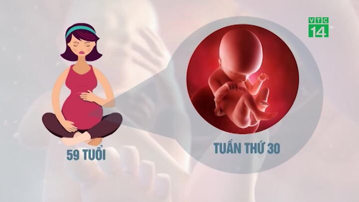 Thai phụ 59 tuổi ở Hà Nội mang thai đứa con đầu lòng