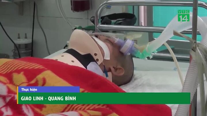 Đuổi theo cướp, người đàn ông bị đạp ngã chấn thương sọ não