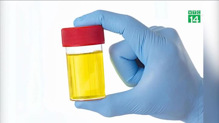 Nước tiểu có thể cho biết khi nào qua đời