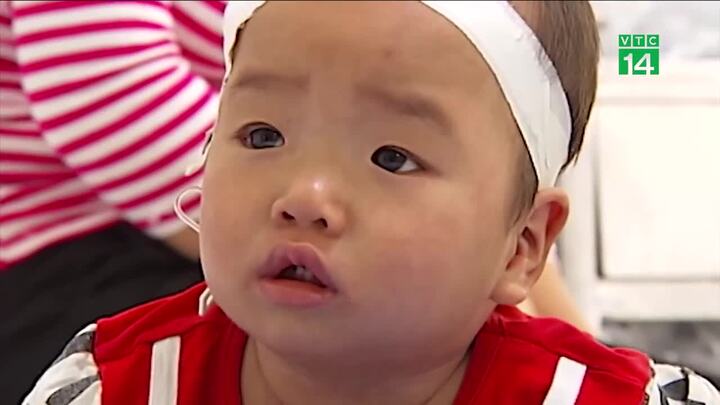 Giao mùa xuân hè, dịch bệnh hoành hành, trẻ ồ ạt nhập viện