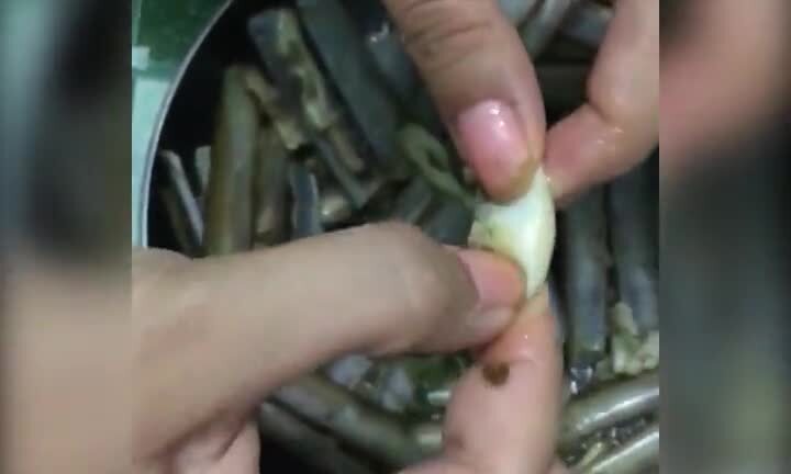 Kinh hoàng giòi nằm trong ruột ốc móng tay