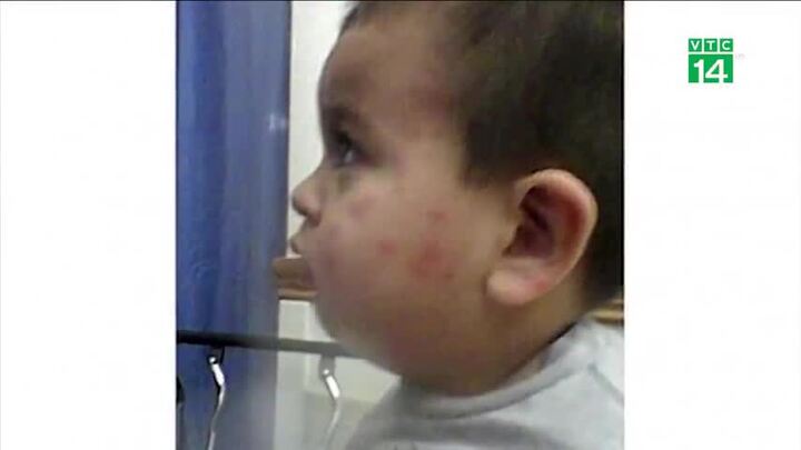 Bị rệp cắn, cả gia đình được bồi thường 36 tỉ đồng